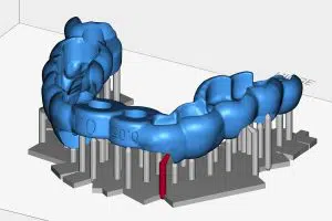 3d-dental-printing-support-generation-algo